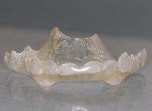 Bruksistična opornica | nočno stiskanje zob | škrtanje z zobmi | bruksizem