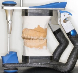 Izdelava bruksistične opornice