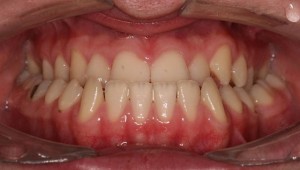 Ortodontsko nerešljiv problem