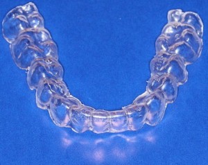Prozorna termoplastična opornica (Clear Aligner Therapy)