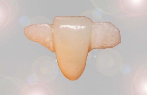 Polnokeramični Maryland mostiček