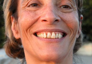 Parodontoza - parodontitis - parodontalna bolezen