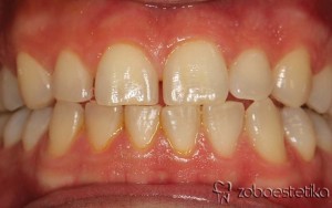 Beljenje zob z ZOOM lučko - Prej