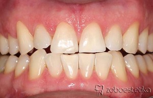 Beljenje zob z ZOOM lučko - Potem