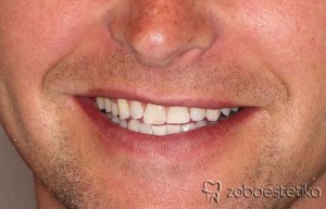 Beljenje zob z ZOOM lučko - Potem