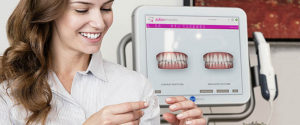 Cena Invisalign zobni aparat