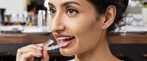 Invisalign - Nevidni zobni aparat