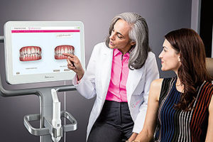 Invisalign - 3D prikaz končnega stanja zdravljenih zob