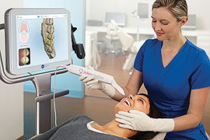 Intraoralno skeniranje zob za Invisalign zobni aparat